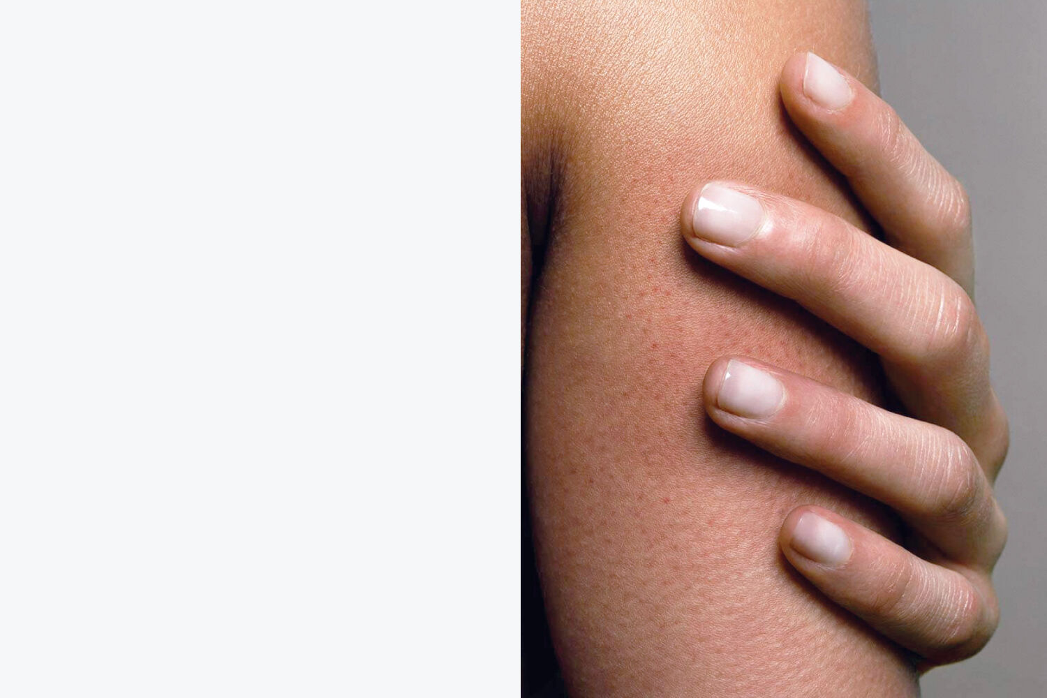 Rough, Bumpy, Flaky Skin