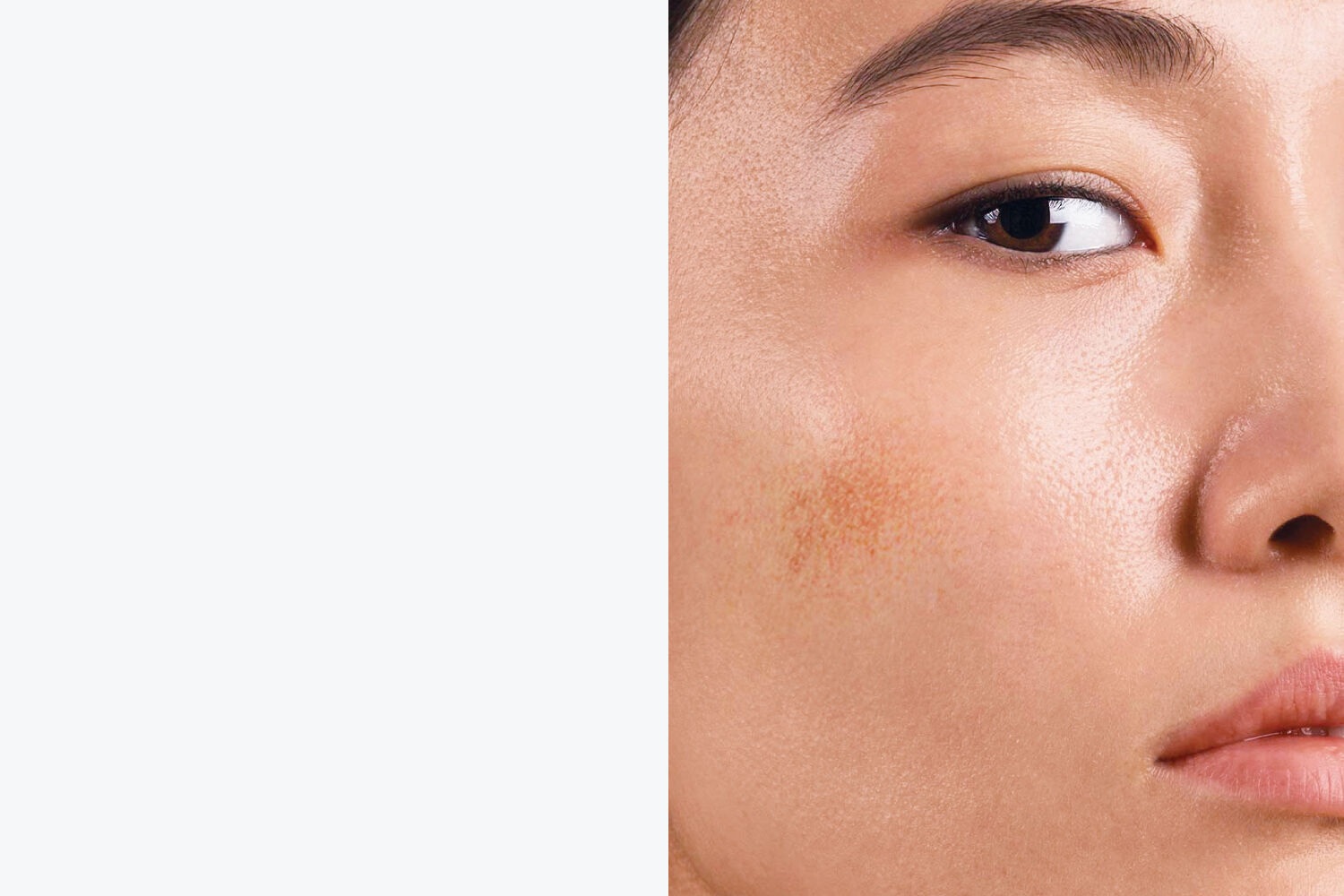 肌膚受刺激、破損